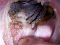 Gill Maggots