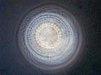 Trichodina
